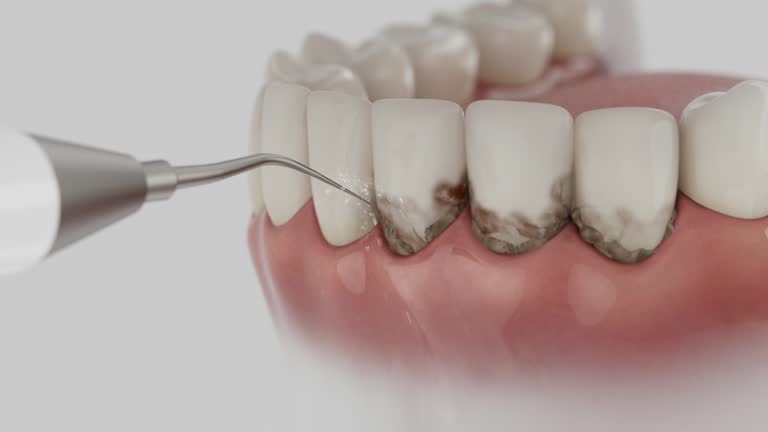 Reliable Root Canal Treatment contractor in Mecklenburg County County, NC by Dentist Open Now